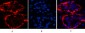 CK17 Monoclonal Antibody(10A1)