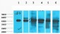 Cytokeratin 18 Monoclonal Antibody(1B3)