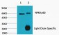 NFkB p65 Monoclonal Antibody(5G6)