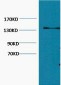 Collagen III Monoclonal Antibody(Q76)