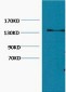 Collagen III Monoclonal Antibody(Q76)