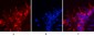 HSP90β Monoclonal Antibody(M2)