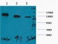 PARP Monoclonal Antibody(M3)