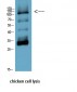 PARP Monoclonal Antibody(M3)