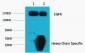 EGFR Monoclonal Antibody(M6)