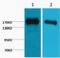 EGFR Monoclonal Antibody(M6)