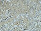 Fibronectin Monoclonal Antibody(M9)