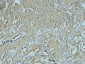 Fibronectin Monoclonal Antibody(M9)