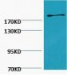 Fibronectin Monoclonal Antibody(M9)