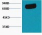 Transferrin Monoclonal Antibody(7F4)