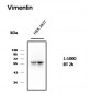 Vimentin Monoclonal Antibody(1A7)