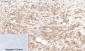 Lactoferrin Monoclonal Antibody(Q100)