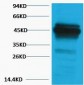 CK18 Polyclonal Antibody