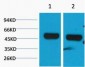 beta 1 Sodium Potassium ATPase Polyclonal Antibody