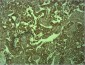 E-cadherin Polyclonal Antibody