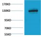 E-cadherin Polyclonal Antibody