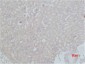 HSC 70 Polyclonal Antibody