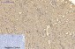 α-SMA Monoclonal Antibody(6A12)