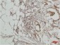 ERK 5 Polyclonal Antibody
