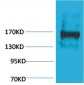 EPG5 Polyclonal Antibody