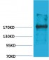 EPG5 Polyclonal Antibody
