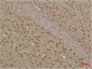 LC3B Polyclonal Antibody