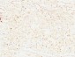 Survivin Monoclonal Antibody(Mix)