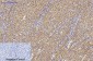 p70 S6 kinase α Polyclonal Antibody