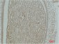 Actinin-α1 Polyclonal Antibody