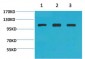 Actinin-α1 Polyclonal Antibody