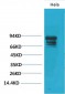 Stat3 Polyclonal Antibody