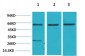 Akt2 Polyclonal Antibody