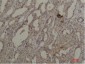 Akt1 Polyclonal Antibody