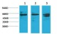 Akt1 Polyclonal Antibody