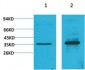 Cyclin D1 Polyclonal Antibody