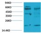 TNF α Polyclonal Antibody