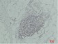 TNF α Polyclonal Antibody