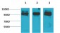 STAT2 Polyclonal Antibody