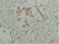 STAT2 Polyclonal Antibody