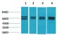 Estrogen Receptor α Polyclonal Antibody