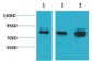 ASIC1 Polyclonal Antibody