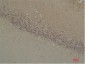 BAI1 Polyclonal Antibody