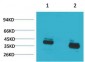 CABP Polyclonal Antibody