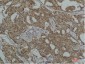 HSC70 Monoclonal Antibody(8G7)