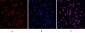 Desmin Monoclonal Antibody(1B12)