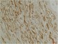 CLIC1 Polyclonal Antibody