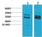 CLIC4 Polyclonal Antibody