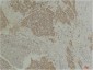 CLIC4 Polyclonal Antibody