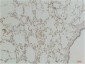 Endothelin B Receptor Polyclonal Antibody