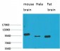 EphA1 Polyclonal Antibody